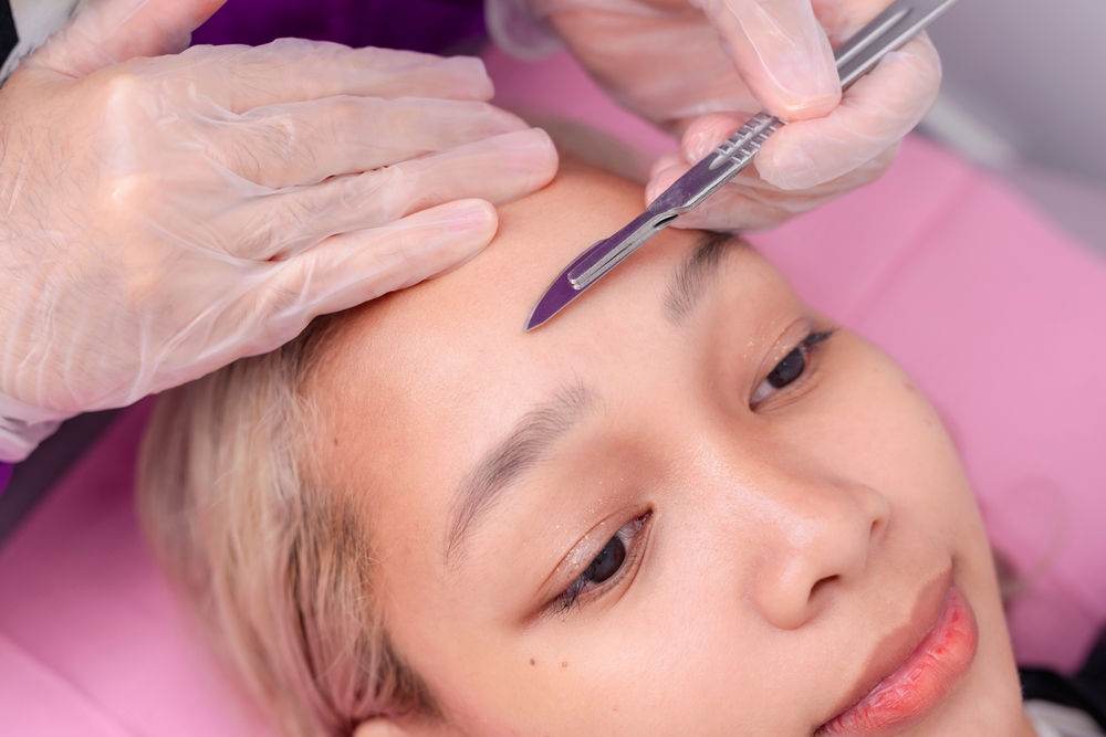 Close-up,Of,A,Dermaplaning,Procedure,Exfoliating,The,Skin,And,Removing