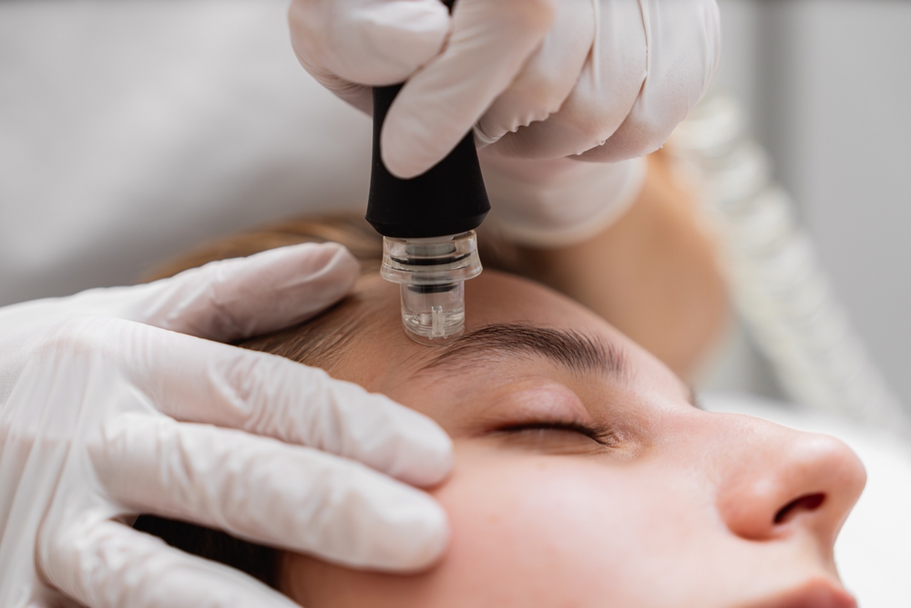 Microdermabrasion,Treatment,Session,At,A,Skincare,Clinic,For,Facial,Rejuvenation